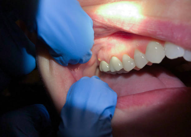 Best Urgent Tooth Repair  in Ada, OK